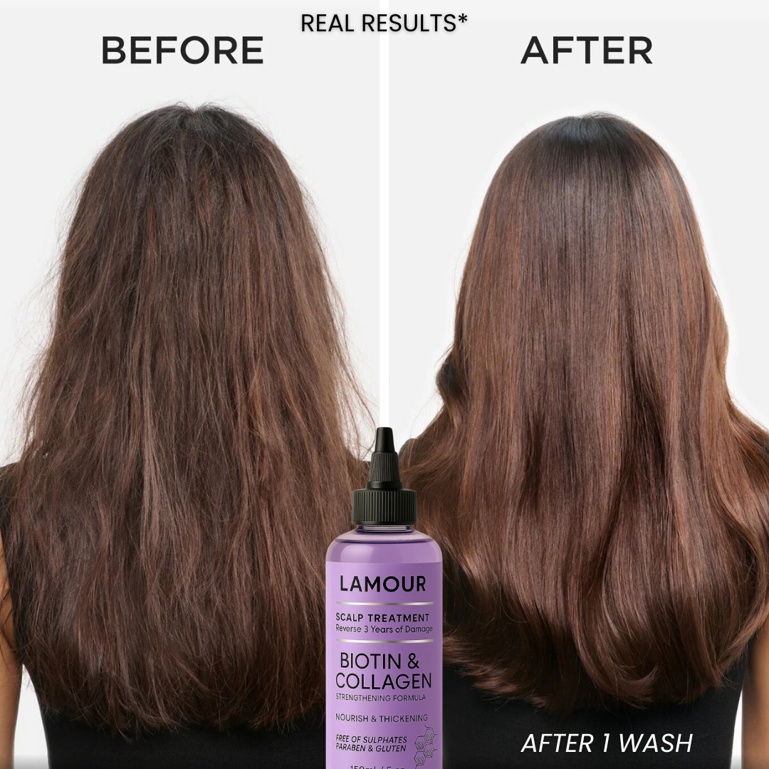Biotin + Collagen ScalpRenew™ Treatment